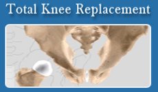 Slider image (4) Dr. S. V. Santpure | Consultant Joint Replacement Surgeon